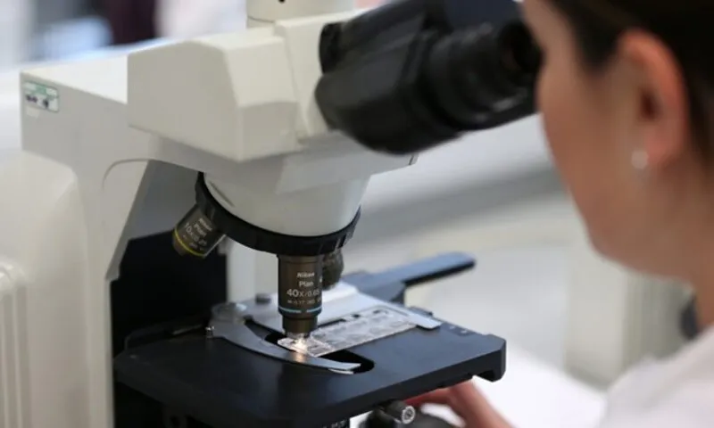 Ức chế protein SPP1 giúp ngăn chặn sự tiến triển của ung thư tuyến tụy