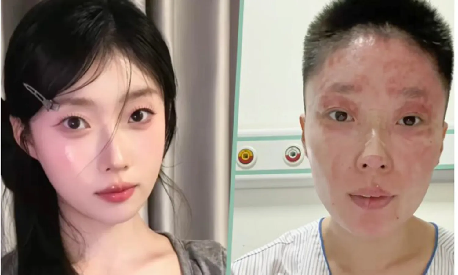 Tong trước và sau khi gặp tai nạn 2