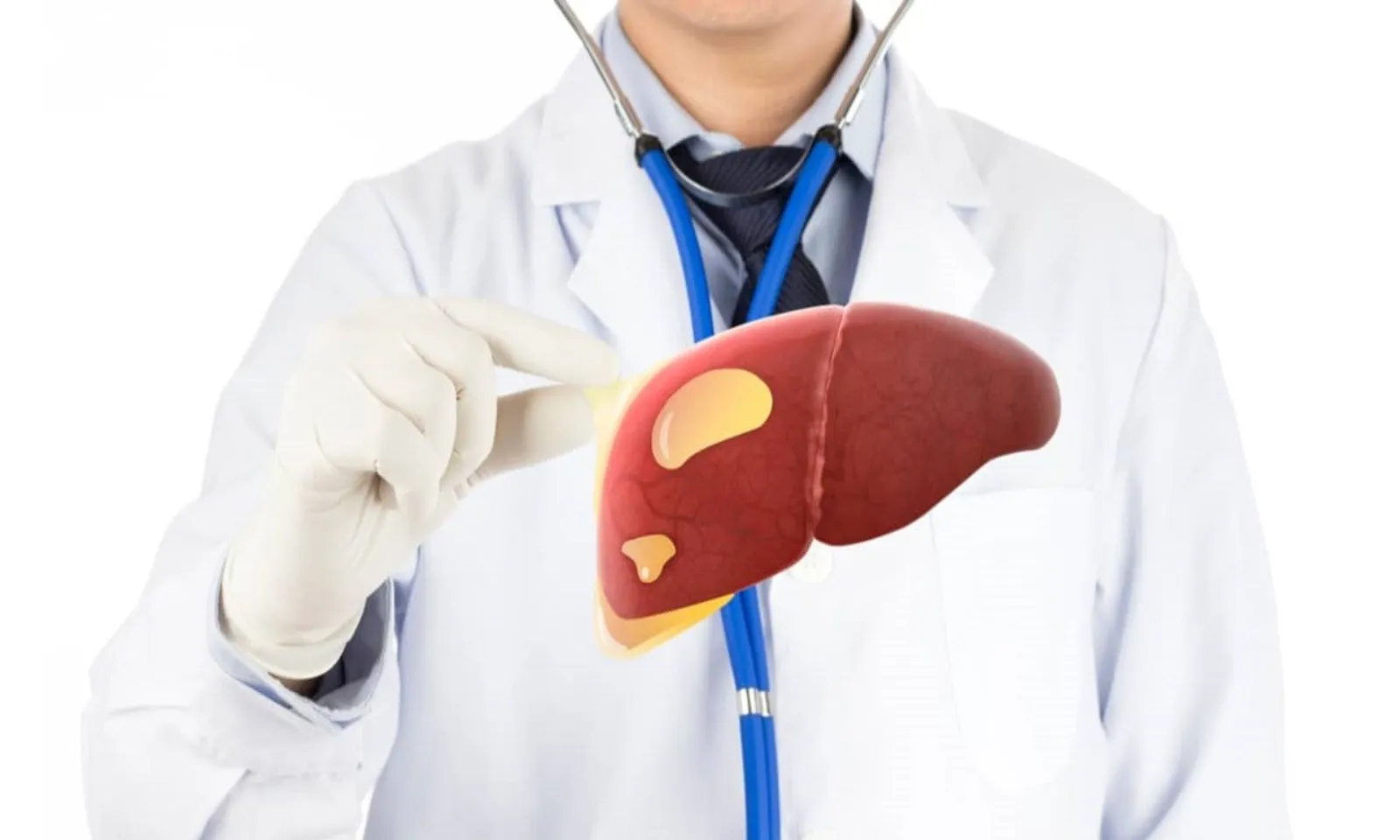 Những thói quen khiến bạn nhanh mắc gan nhiễm mỡ