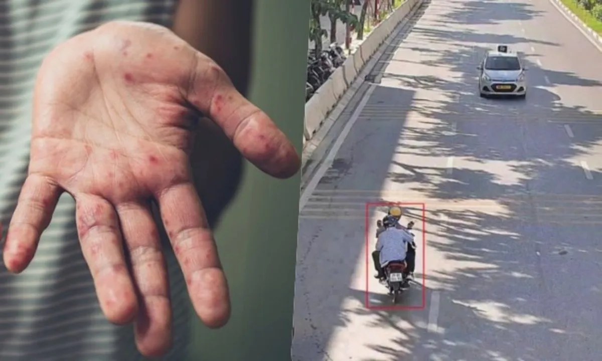 Điểm tin sáng 3/10: Bệnh tay chân miệng ở TPHCM tăng | 10 phường, xã ‘nóng’ về vi phạm giao thông