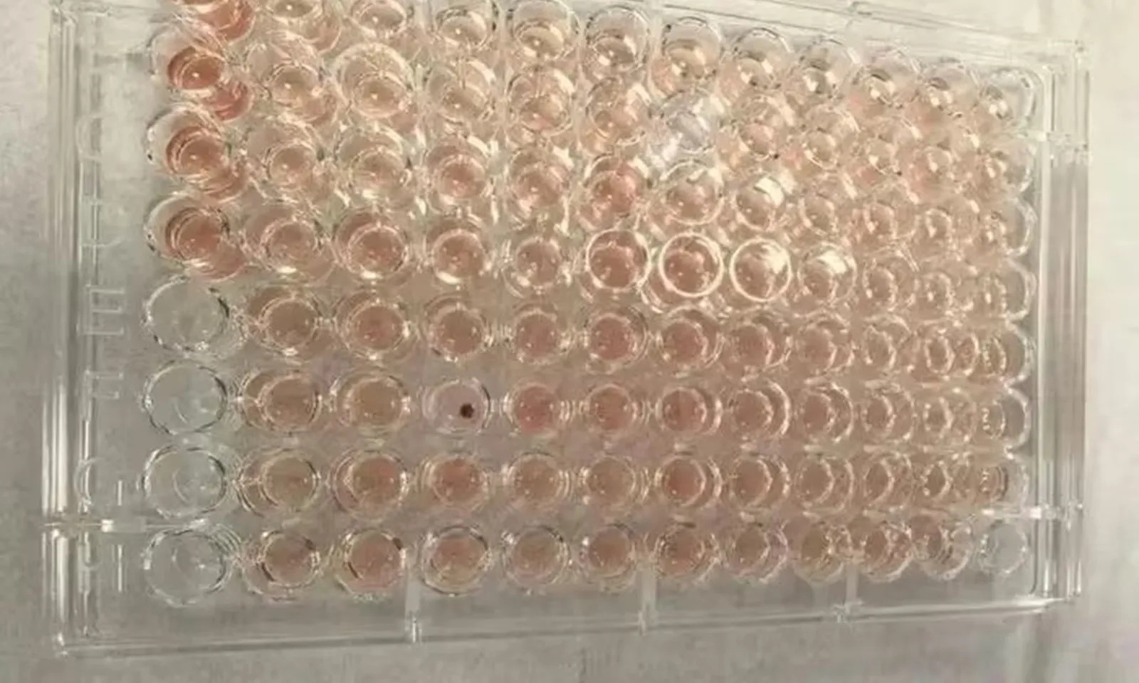 Người đàn ông Trung Quốc mang nhóm máu hiếm nhất thế giới