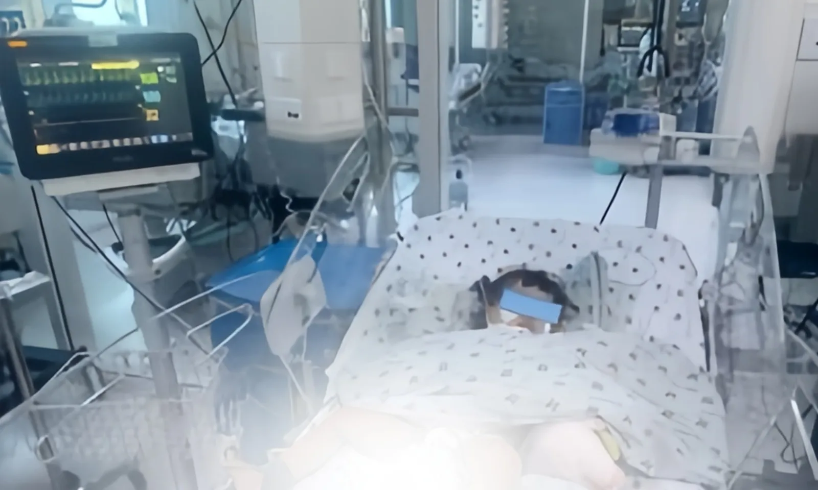 Kịp thời cứu em bé 17 tháng tuổi bị ngạt nước nặng do té vào xô nước