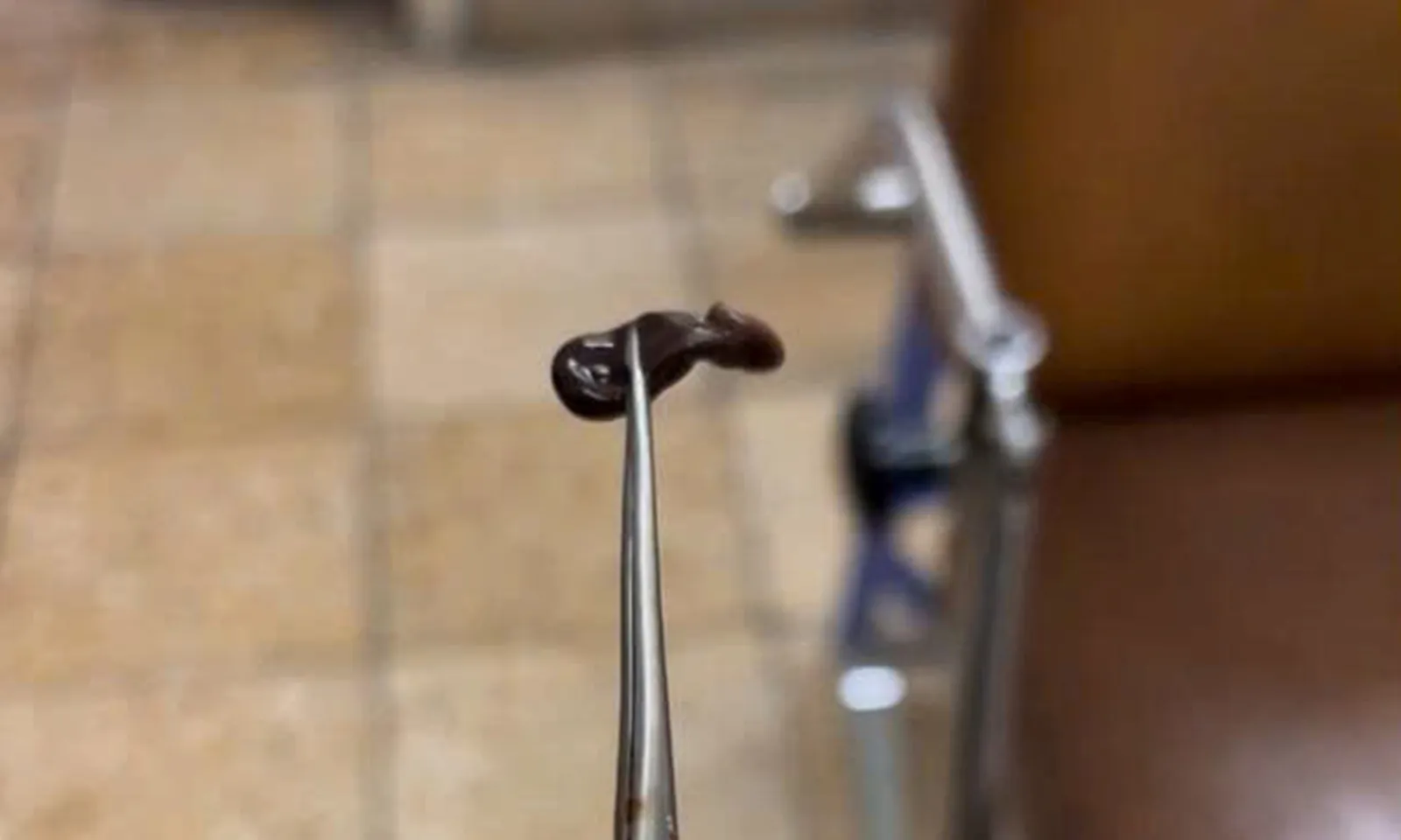 Đi tắm suối, bé trai bị vắt chui vào mũi, ký sinh suốt 3 tuần