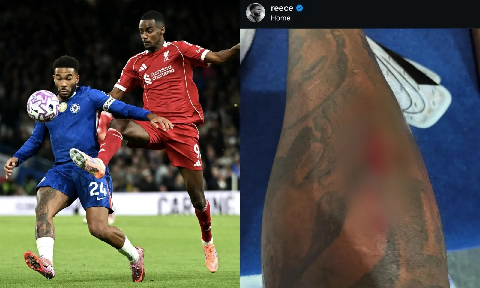 Reece James rút lui khỏi tuyển Anh sau khi chơi 3 vị trí trước Liverpool