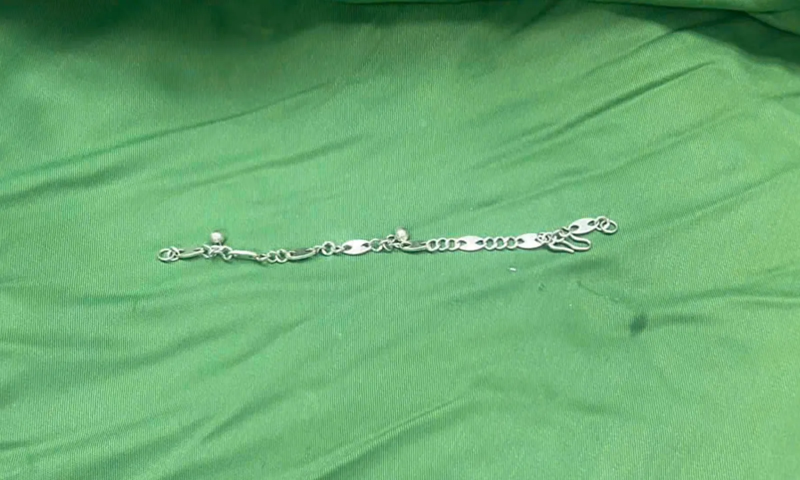 Bé gái 5 tuổi nuốt vòng tay bạc dài 7cm