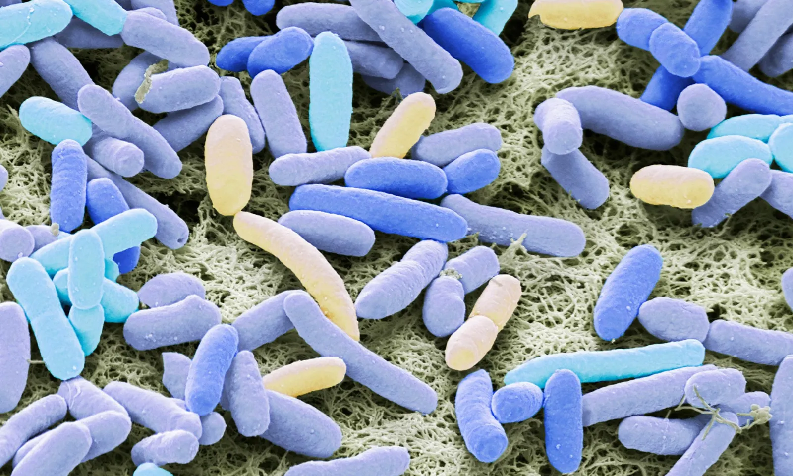 WHO cảnh báo: Tình trạng kháng thuốc kháng sinh tăng vọt trên toàn cầu