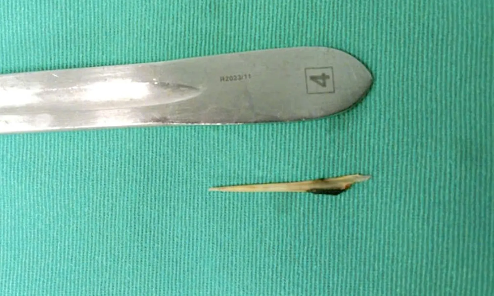 Xương cá dài 4cm đâm thủng ruột người đàn ông lớn tuổi