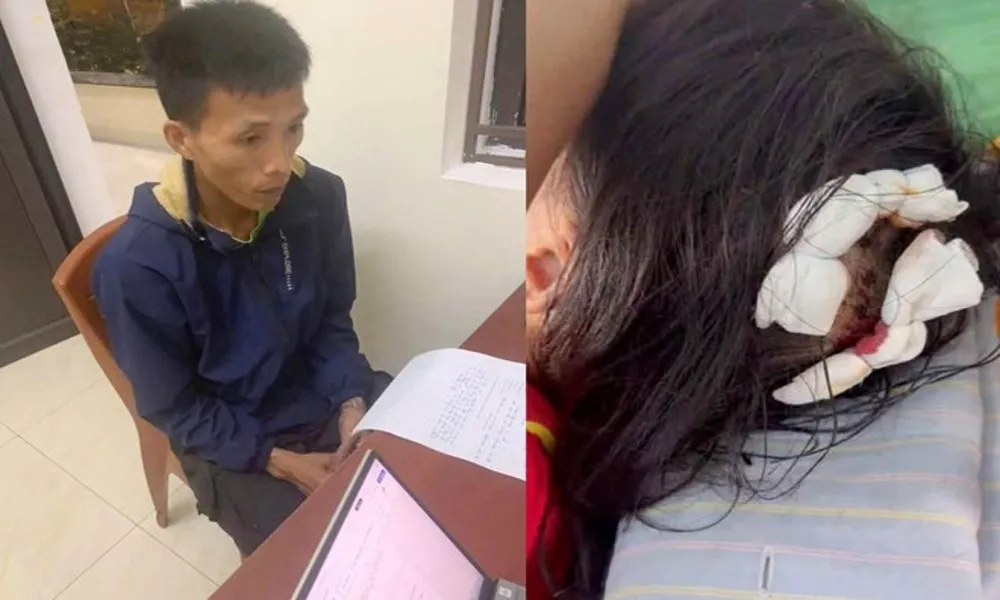 Điều tra cha dượng hành hung bé gái 10 tuổi nhập viện
