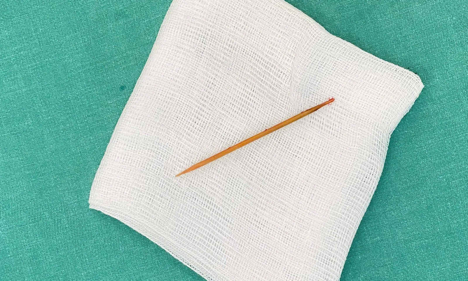 Cứu người đàn ông bị tăm tre đâm xuyên qua thành ruột