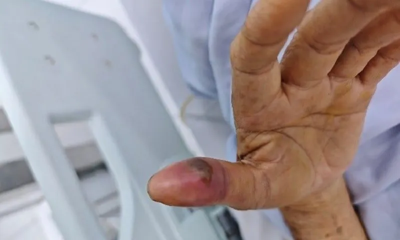 Người đàn ông bị rắn lục đuôi đỏ cắn ngay trong nhà