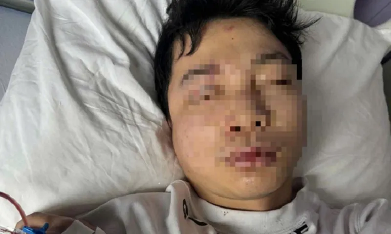 Huế: Nam DJ bị đánh hội đồng giữa phố đi bộ, phải nhập viện 