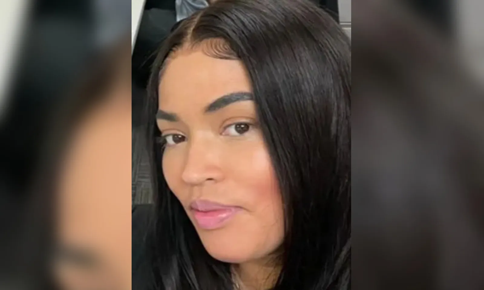 Nữ cảnh sát qua đời sau một tuần phẫu thuật nâng mông