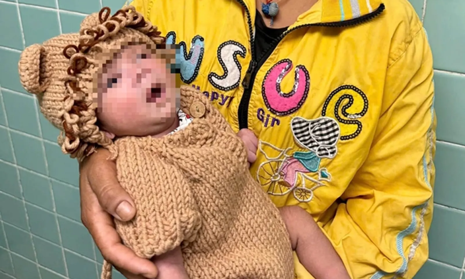 Bé sơ sinh 5 ngày tuổi bị thủng dạ dày vì mẹ cho ăn cơm