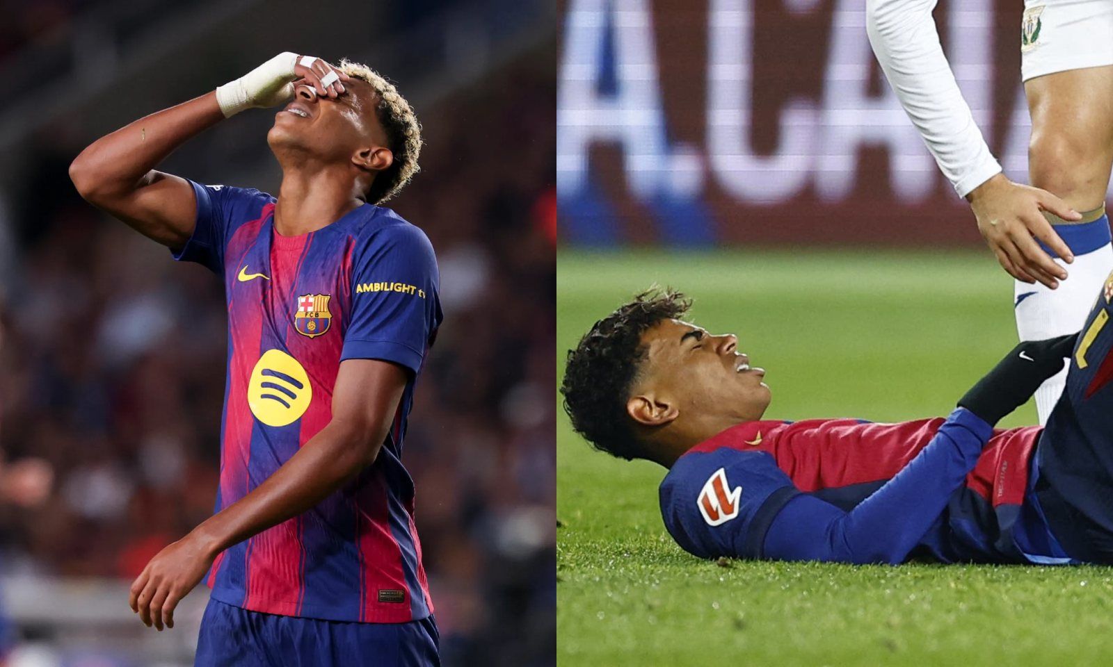 Yamal dính chấn thương mãn tính, Barca quyết định hoãn phẫu thuật