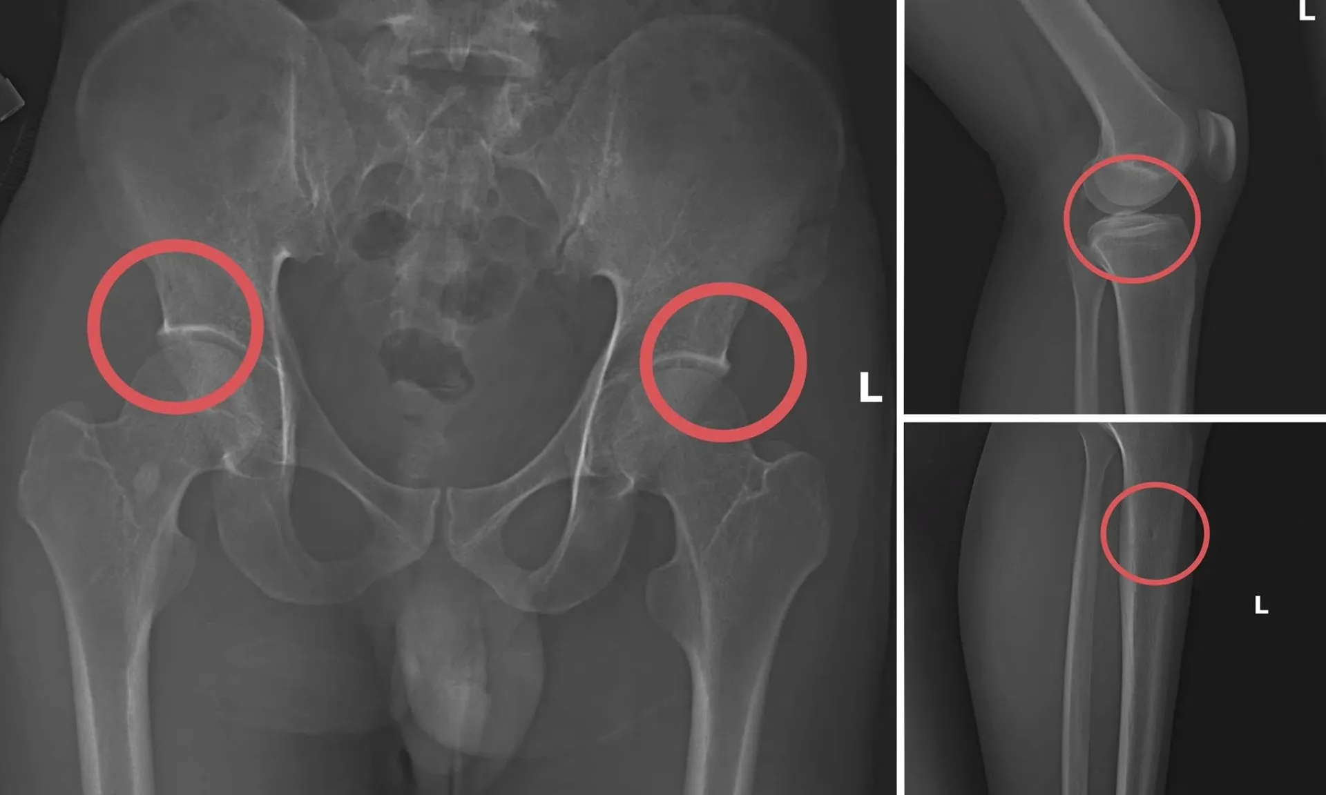 doi-tuong-chau-1411251