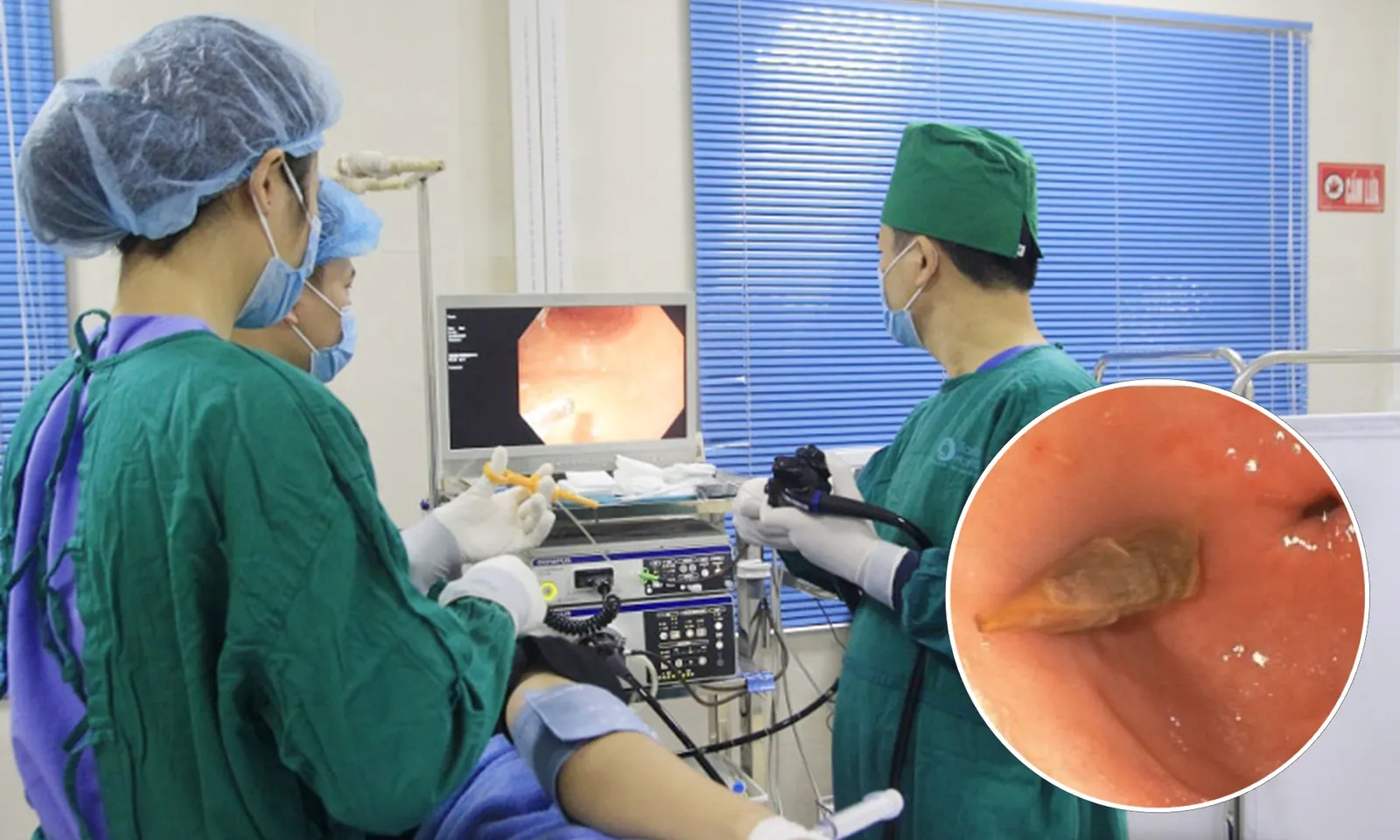 Vô tình nuốt hạt táo đỏ khi ăn cháo yến