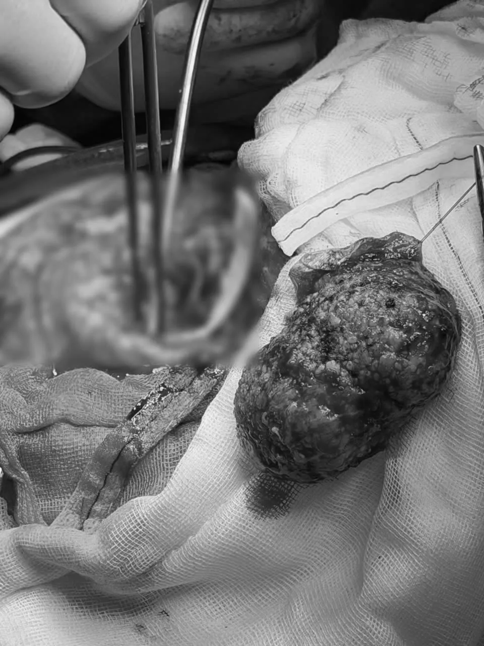 z7271826737654_a8e90dc7ef72d0c0066103981773d761