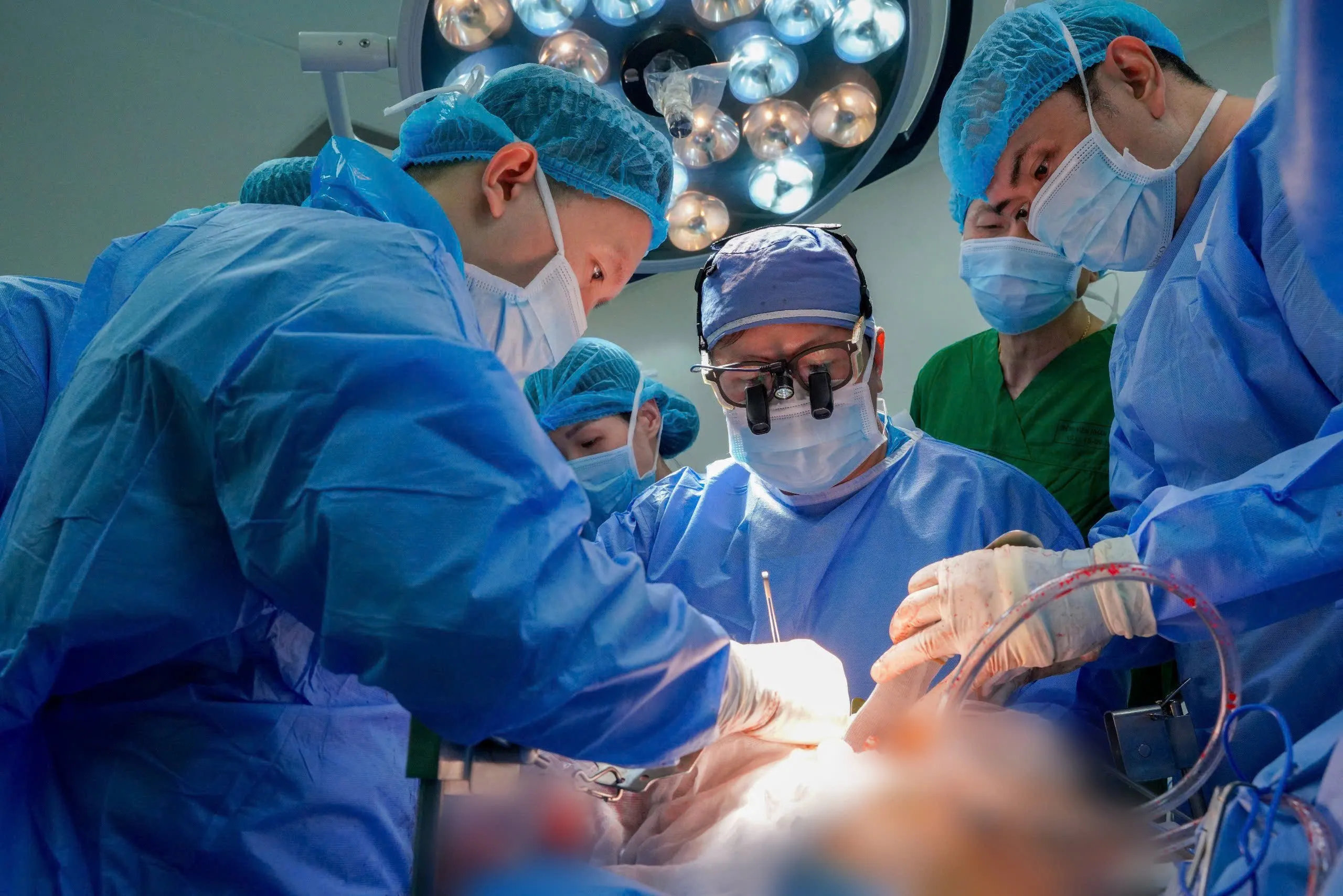 Ê-kíp ghép gan do TS BS. Trần Công Duy Long, Phó trưởng Khoa Gan Mật Tuỵ, Trưởng Ê-kíp ghép gan, phẫu thuật viên chính, phụ trách, phối hợp chặt chẽ trong 