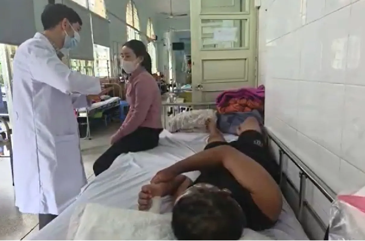 Một trường hợp bỏng pháo tại Bệnh viện Nhi đồng 2