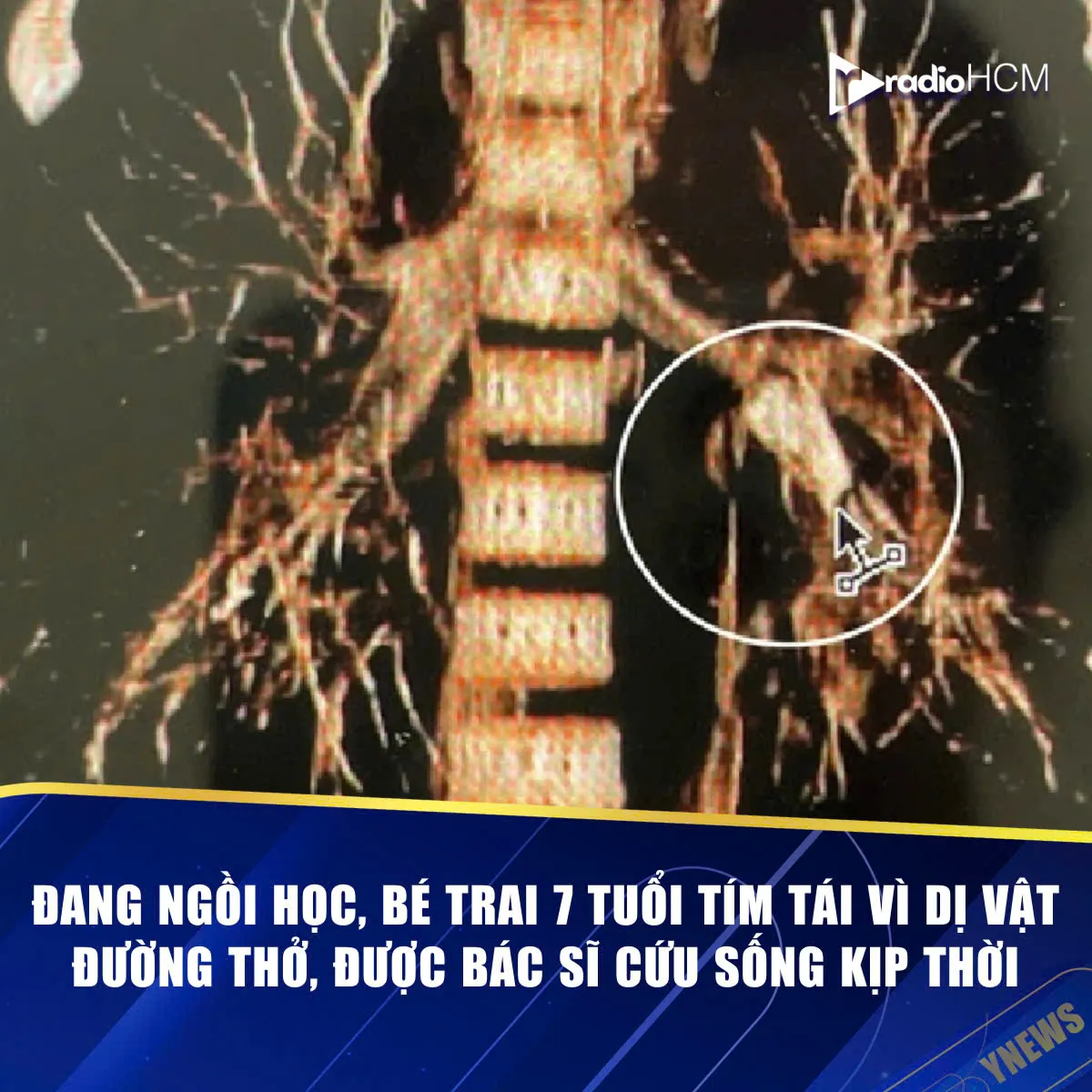 z7455790553955_6d635ac4422363366a71f95700649ac0