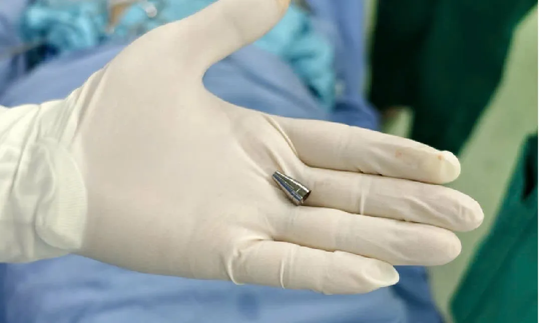 Đà Nẵng: Cứu sống bé trai 7 tuổi bị ngòi bút rơi vào đường thở