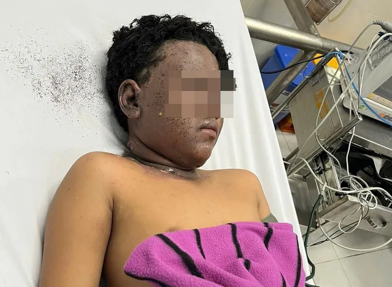 Cảnh báo tai nạn ở trẻ em trong dịp Tết