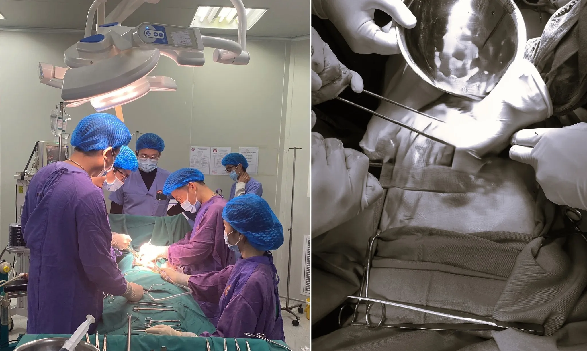 Kịp thời cứu sống người đàn ông nguy kịch do ngã từ độ cao 4m khi dọn nhà đón Tết