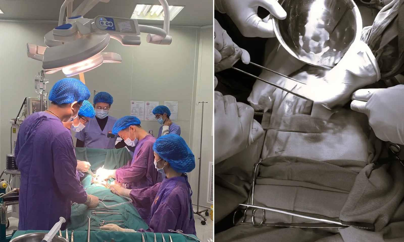 Kịp thời cứu sống người đàn ông nguy kịch do ngã từ độ cao 4m khi dọn nhà đón Tết