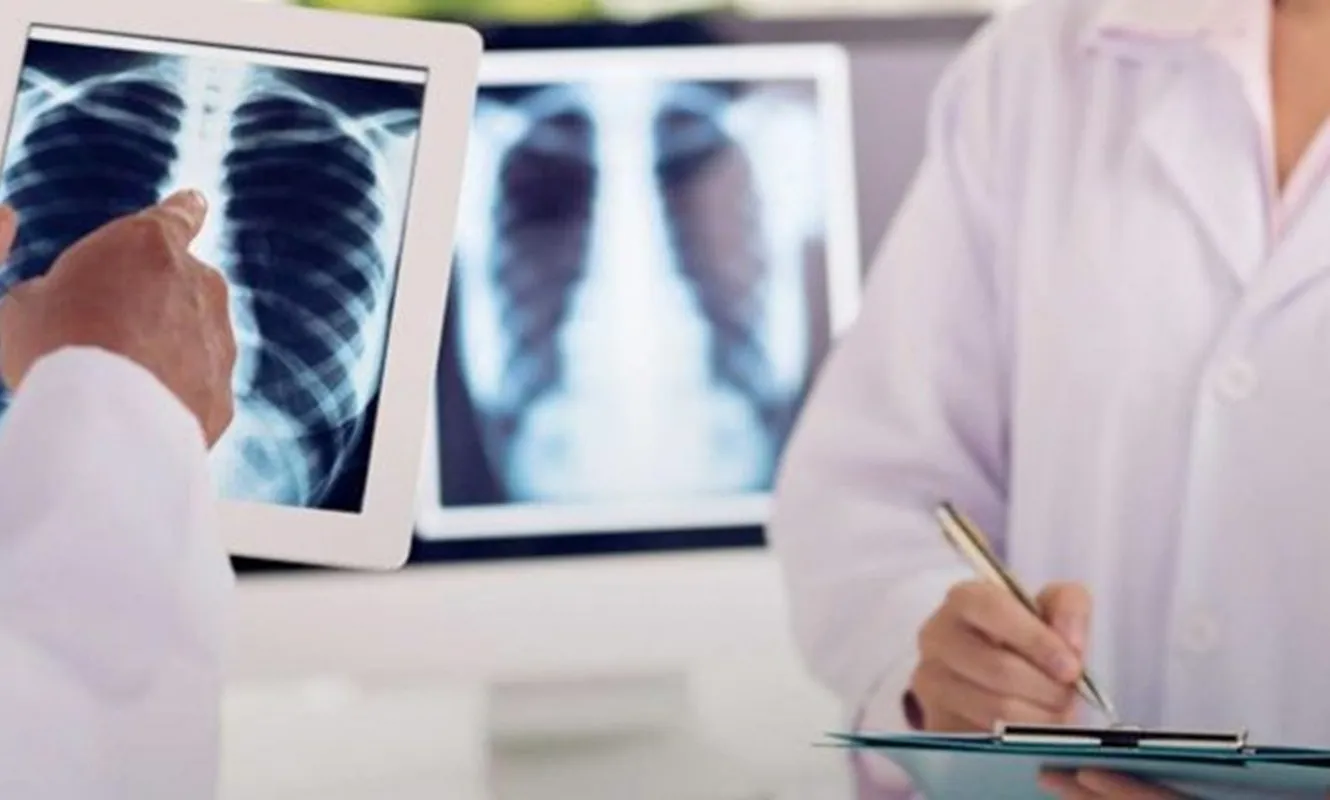 Tranh cãi quy định chụp X-quang đủ 6 phút mới được thanh toán BHYT