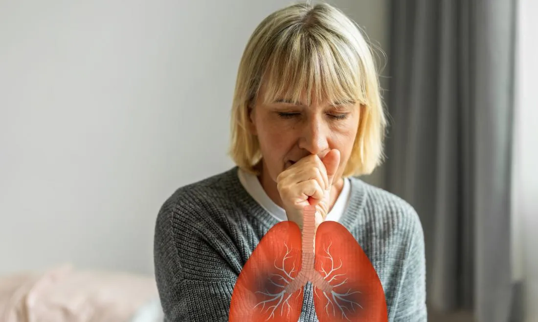 Cảnh báo lao tiềm ẩn và các biện pháp phòng ngừa hiệu quả