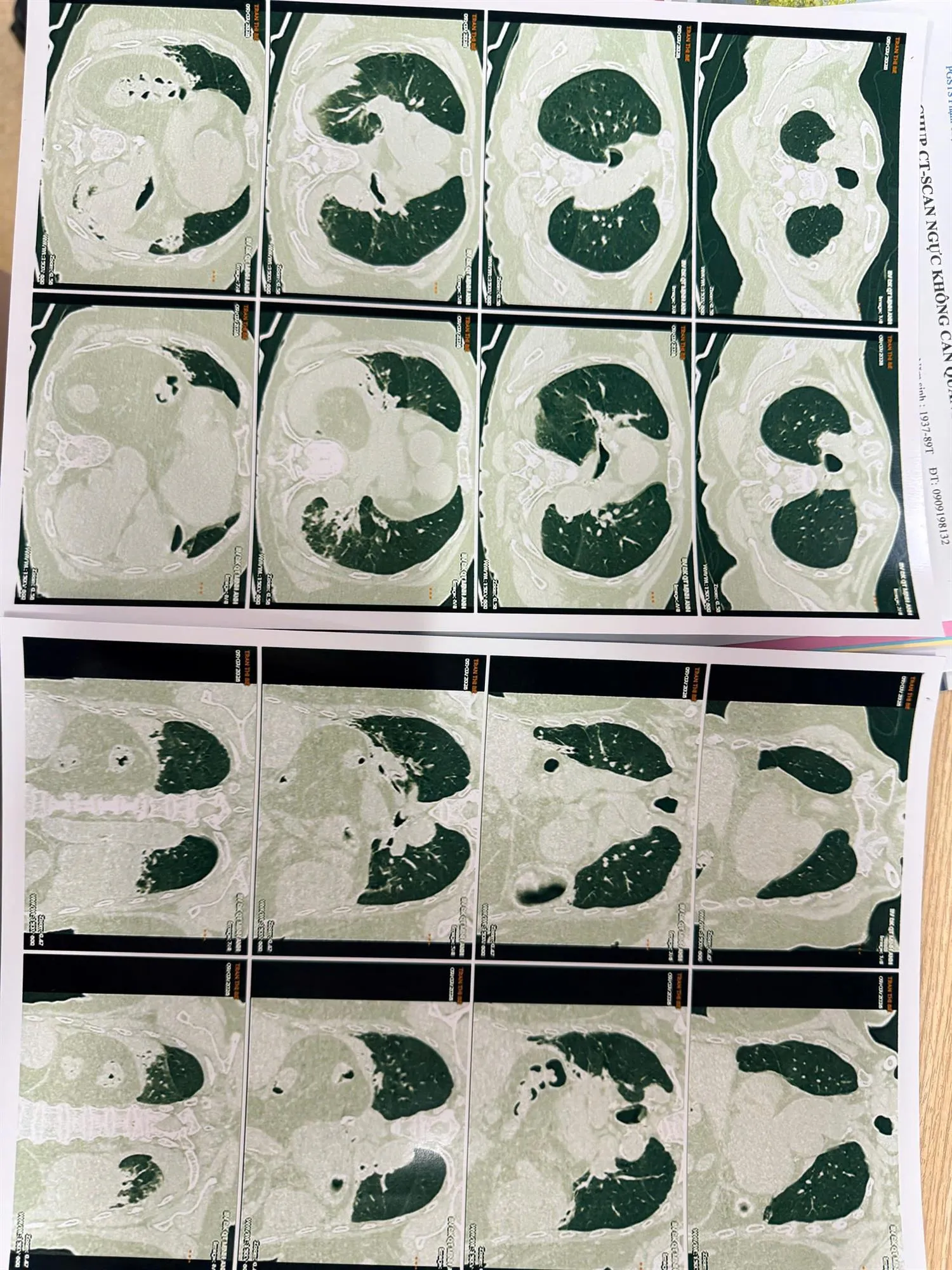 z7648626566235_fdb794491bbfd9116655d9e8e9529d68