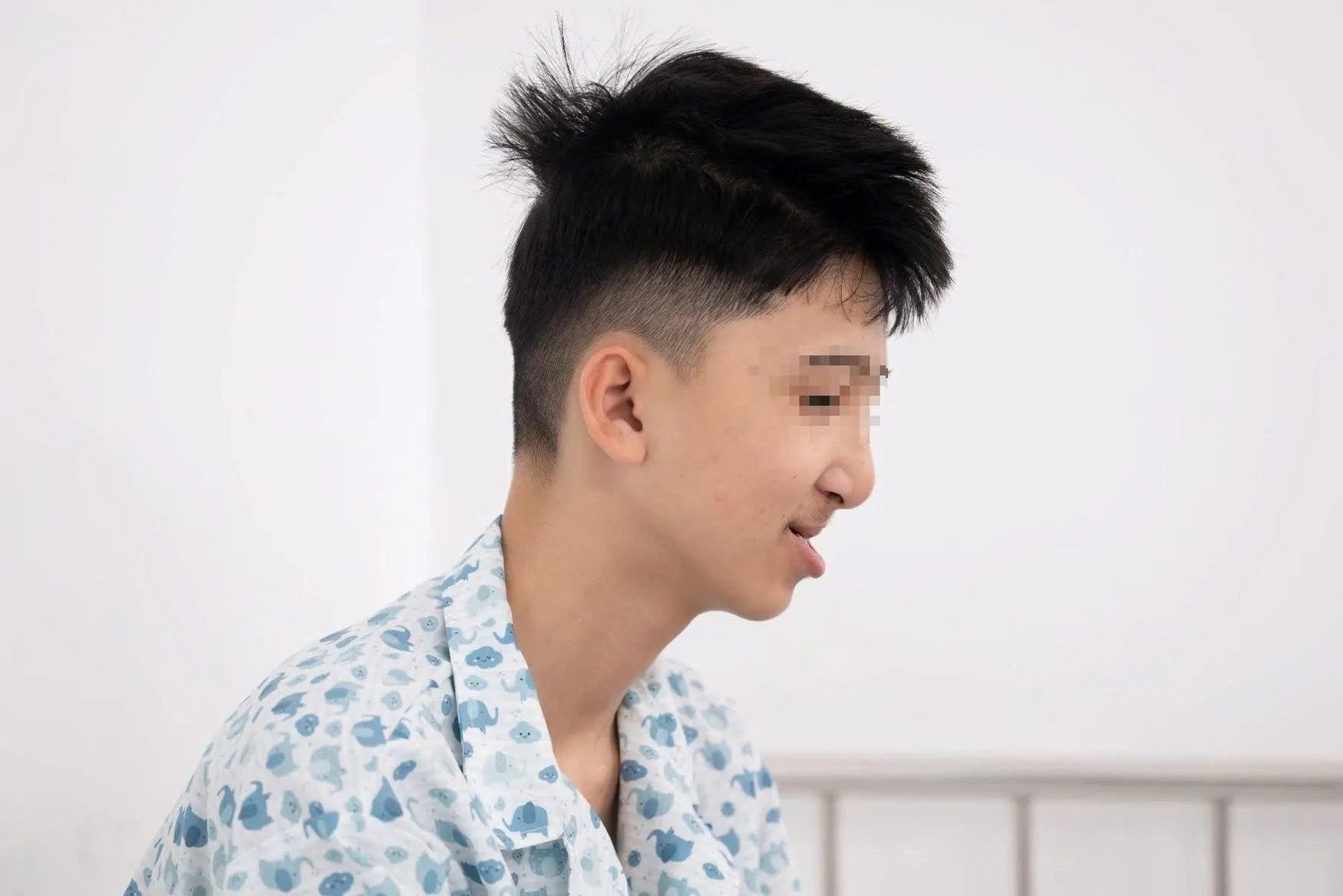 Bệnh nhi 16 tuổi tái tạo xương hàm