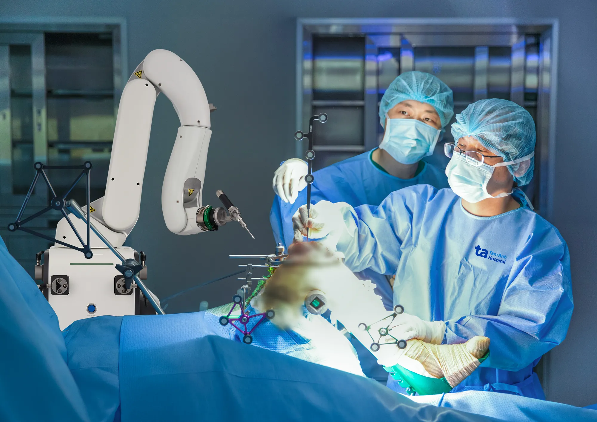 Bác sĩ đang phẫu thuật thay khớp gối cho người bệnh bằng Robot AI thế hệ mới CUVIS-Joint (2)