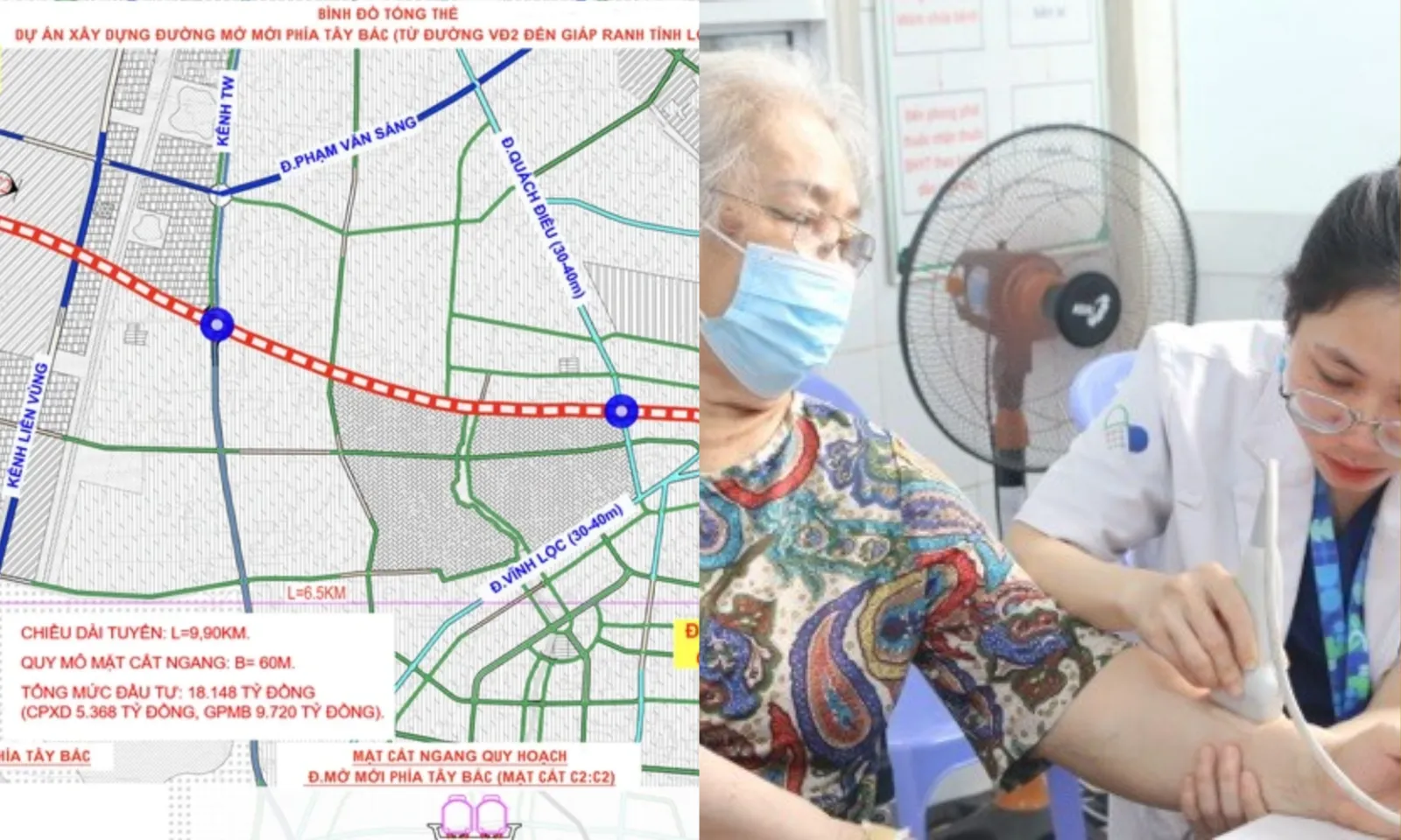 Điểm tin trưa 17/4: Khám sức khỏe miễn phí tại TPHCM | Dự án đường thẳng nối TPHCM đi Tây Ninh