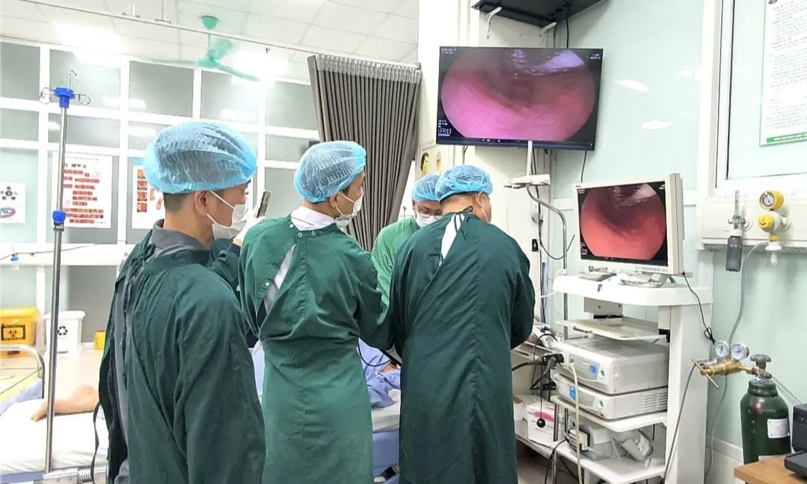 Hồi sinh thực quản hẹp khít suốt 10 năm do nhiễm nấm