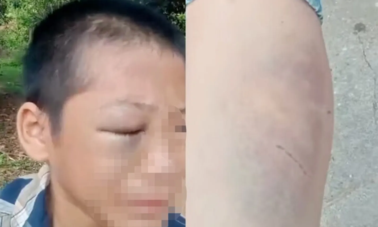ảnh minh họa + thumb  - 2