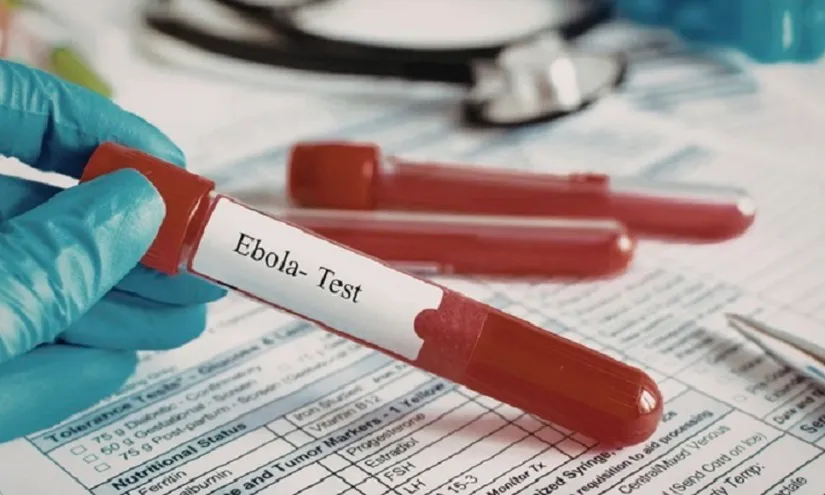 TPHCM yêu cầu tăng cường phòng chống nguy cơ xâm nhập bệnh do virus Ebola