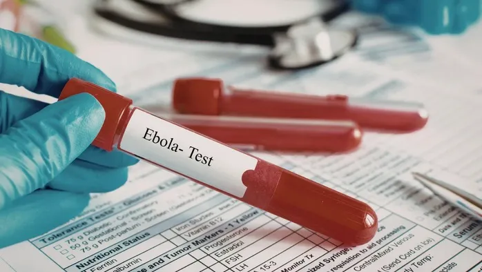 ebola
