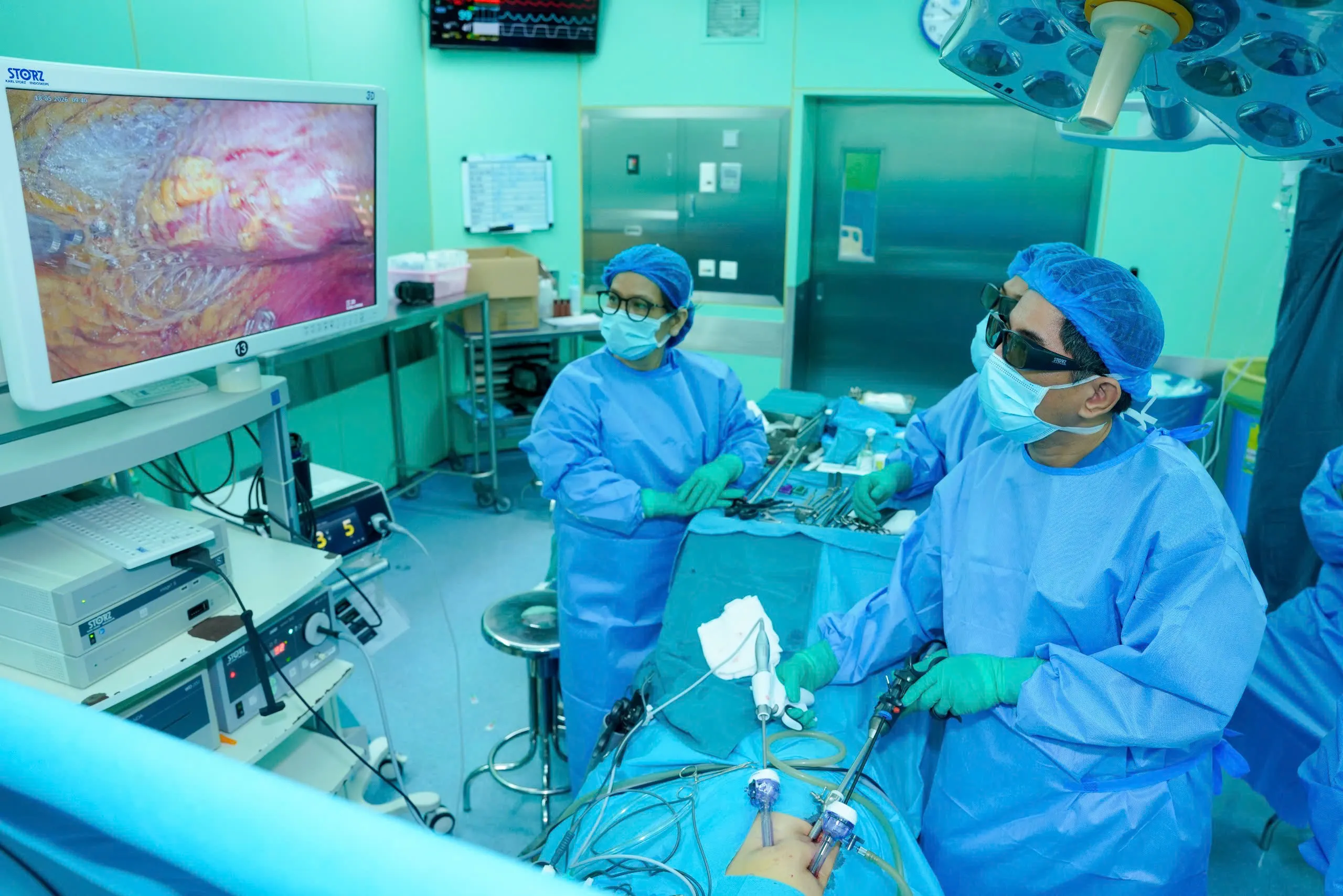 Hình ảnh nội soi được theo dõi liên tục trong phòng mổ, hỗ trợ ê-kíp đánh giá chính xác cấu trúc giải phẫu và xử trí phù hợp trong quá trình phẫu thu