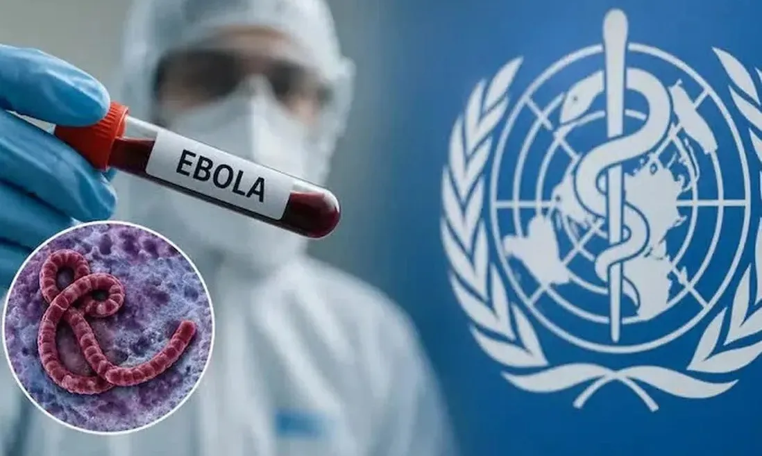 Bộ Y tế ban hành hướng dẫn mới về chẩn đoán, điều trị Ebola