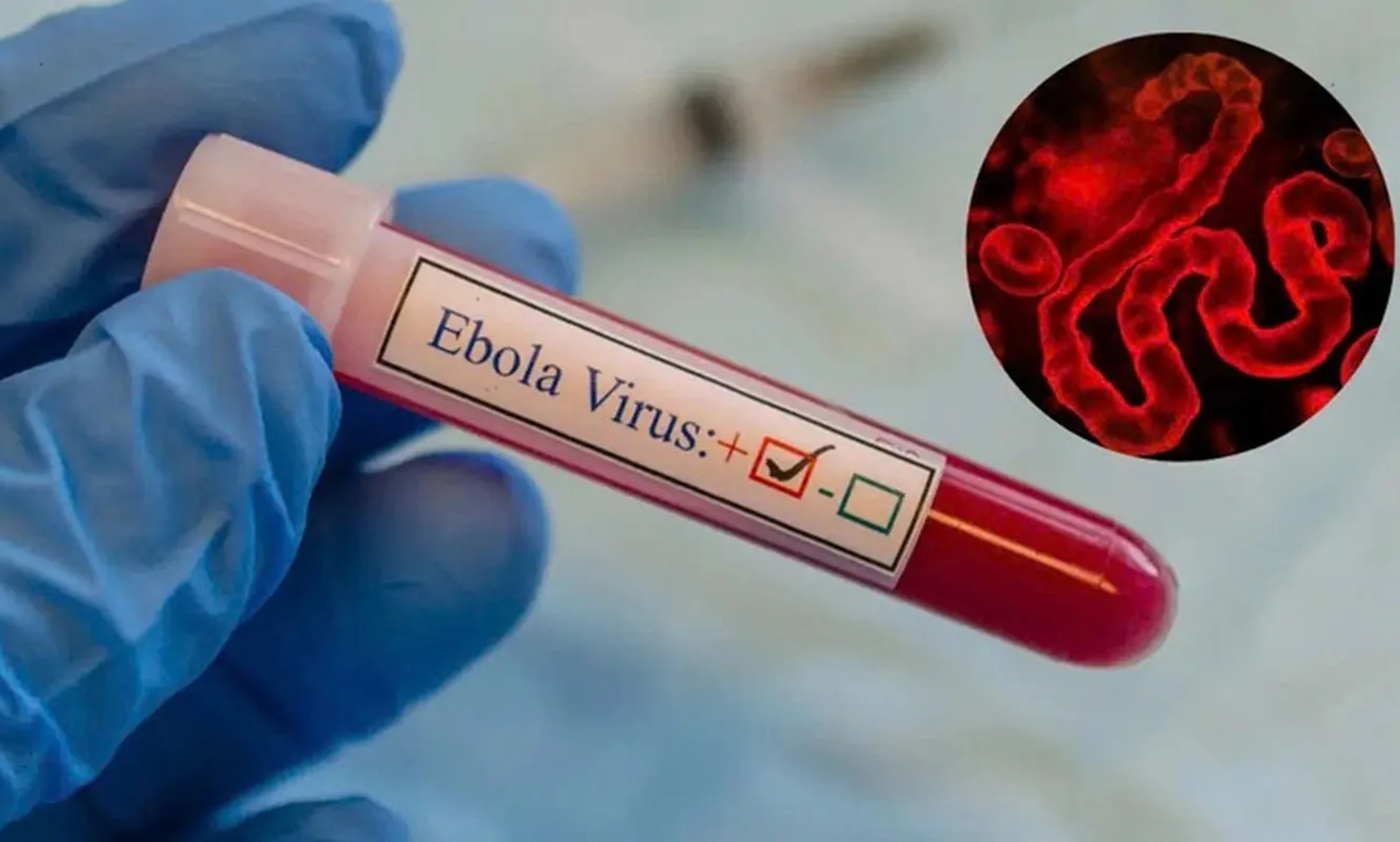 Xuất hiện Ebola chủng mới bùng phát