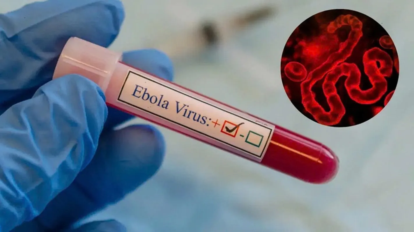 Virus Ebola có xu hướng lan rộng