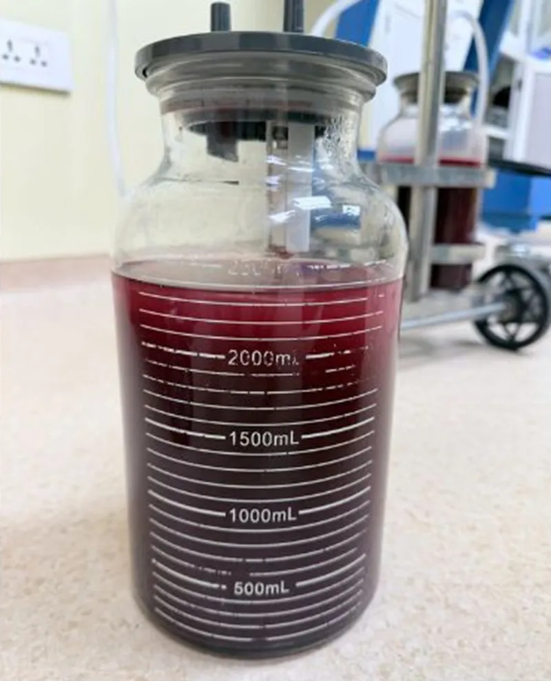 dịch được hút