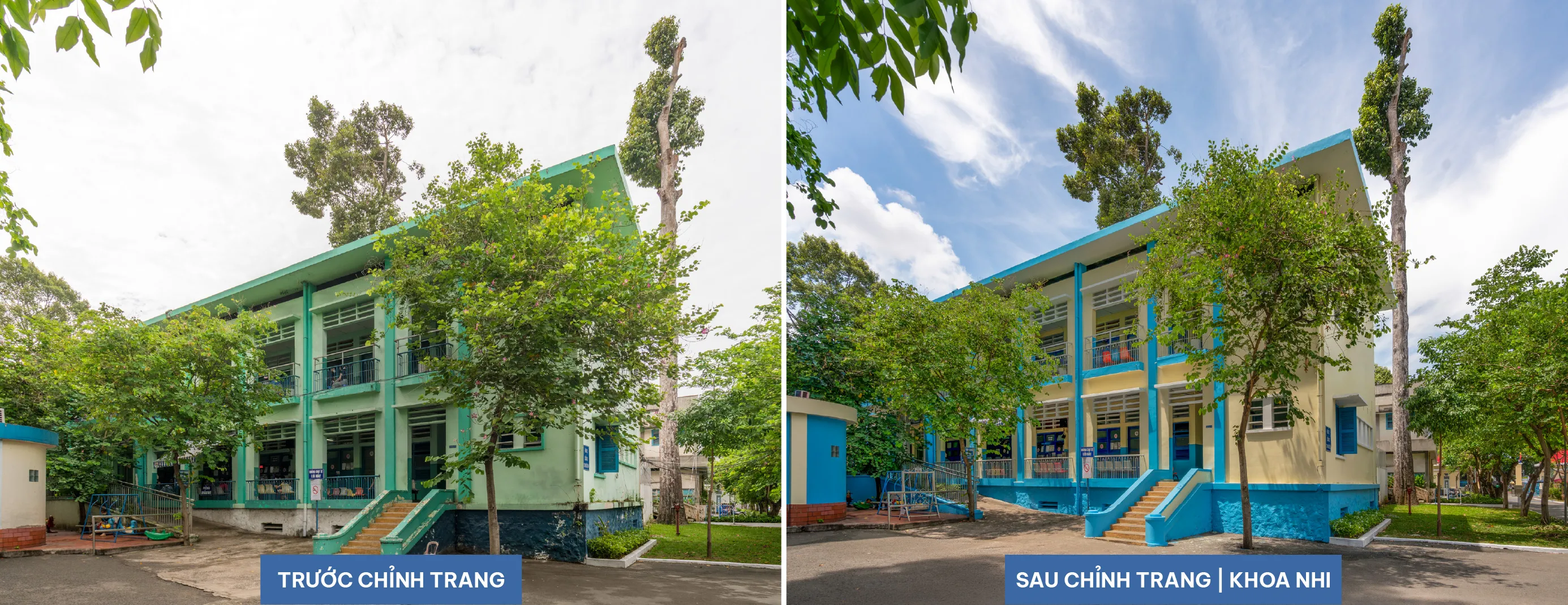 Khoa nhi Before After