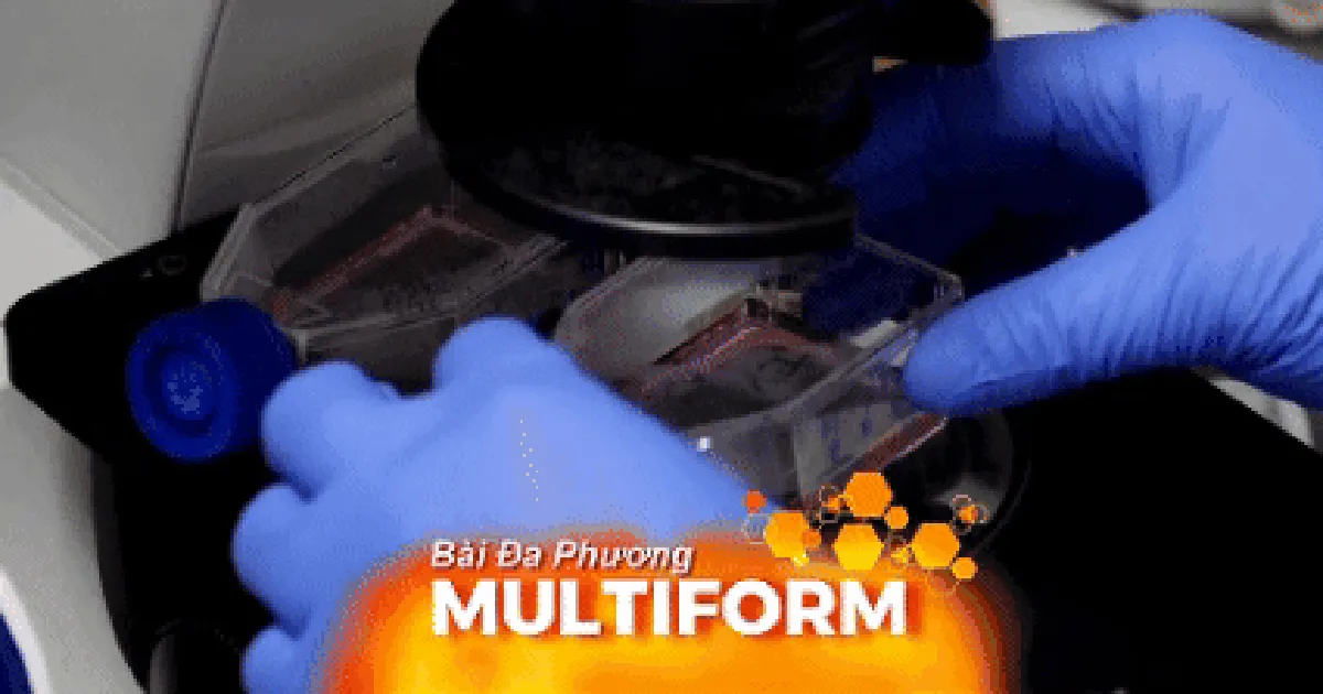 Xét nghiệm máu mới có thể dự báo nguy cơ Alzheimer trước 5 - 10 năm
