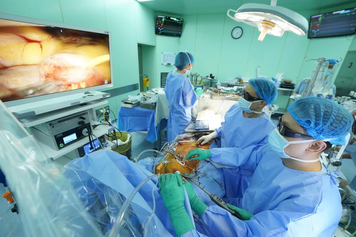 Ê kíp Khoa Phẫu thuật Tim mạch thực hiện phẫu thuật nội soi xâm lấn tối thiểu qua đường mổ khoảng 4 cm để xử lý đồng thời ba van tim và khâu bít tiểu nhĩ