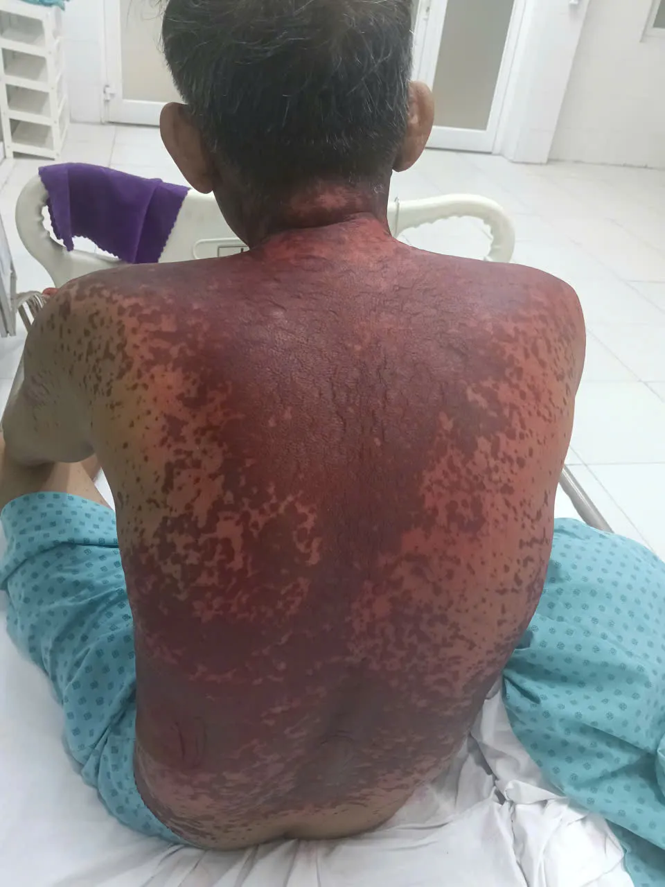 Nhỏ thuốc mắt, bệnh nhân nguy kịch (1)