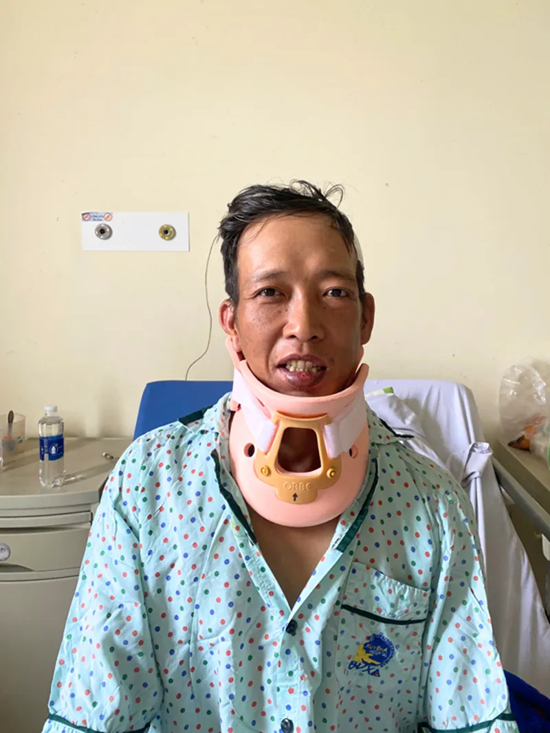CỔ THẲNG TRỞ LẠI SAU CA MỔ