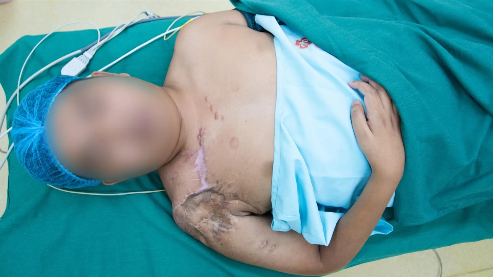 Trước phẫu thuật