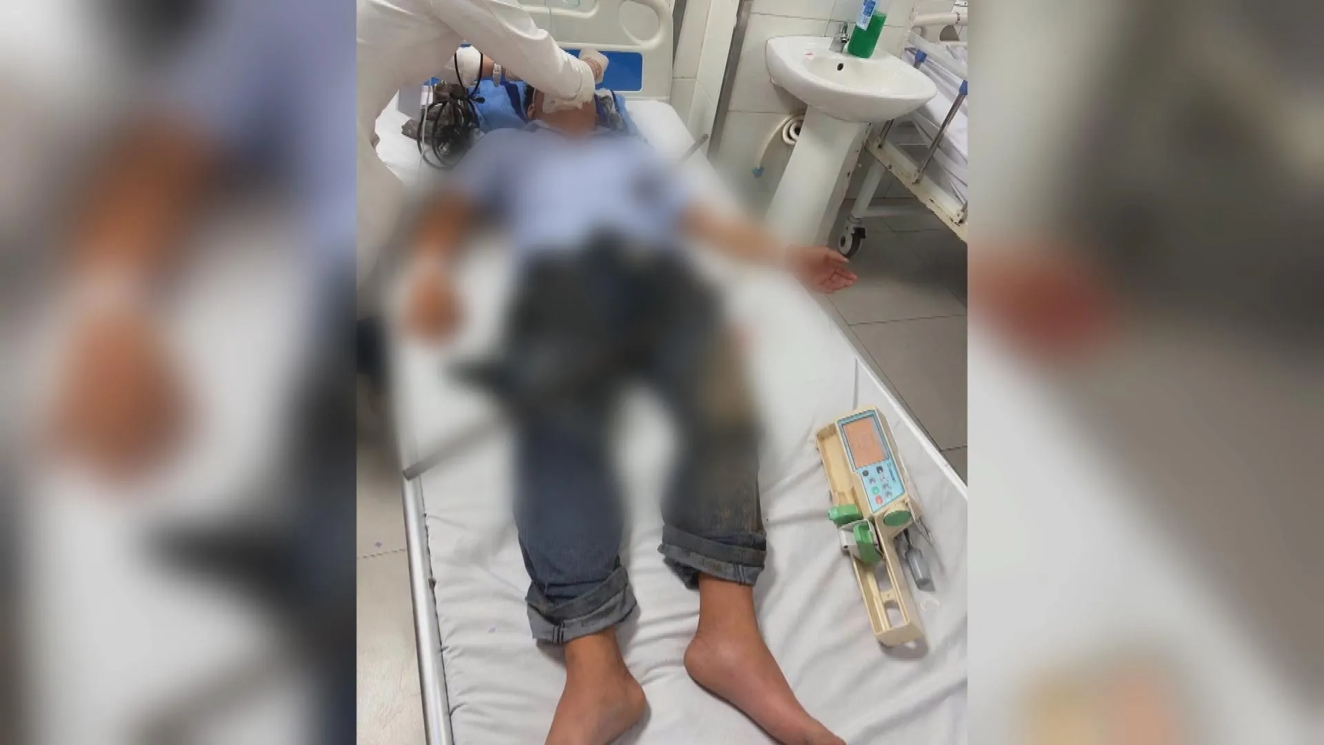 Cấp cứu một người đàn ông bị 2 thanh sắt đâm xuyên qua đùi và bụng | 60 Giây Sáng ngày /9/2026 - Ảnh 5. Cấp cứu một người đàn ông bị 2 thanh sắt đâm xuyên qua đùi và bụng | 60 Giây Sáng ngày /9/2026 - Ảnh 5.